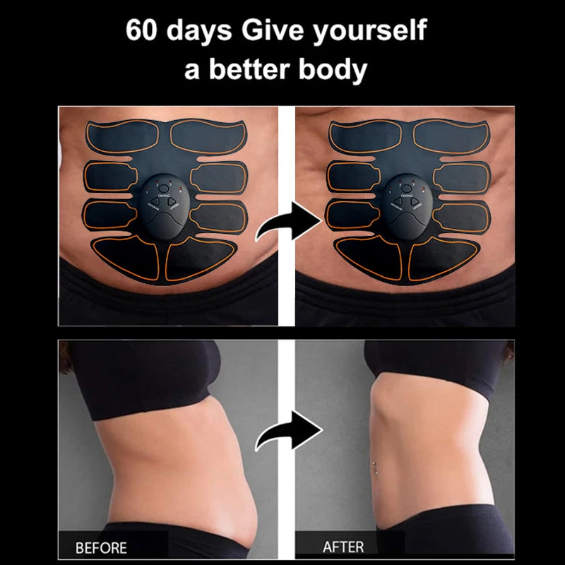 Kyroxs™ EMS Muscle Stimulator – Full Body Training & Muscle Toning Device